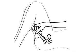 Mano che stringe una siringa con ago inserito nella pelle del braccio, tecnica di iniezione sottocutanea illustrata con linee semplici