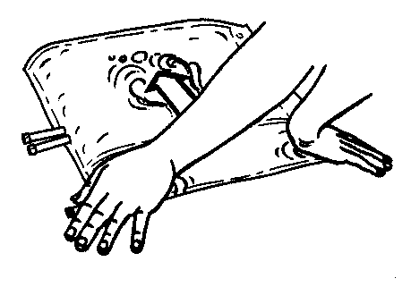 Braccio con ago inserito nella pelle, mano che tiene la siringa e dispositivo di sicurezza attivo per prevenire punture accidentali