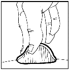 Mano che stringe una penna per insulina con ago esposto puntato verso la piega cutanea addominale