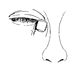 Occhio che riceve una goccia oftalmica con un contenitore bianco inclinato verso il basso