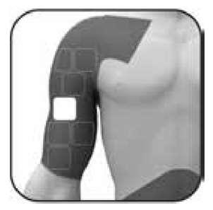 Braccio umano con area evidenziata in grigio scuro a forma di riquadro e spazio bianco centrale per iniezione