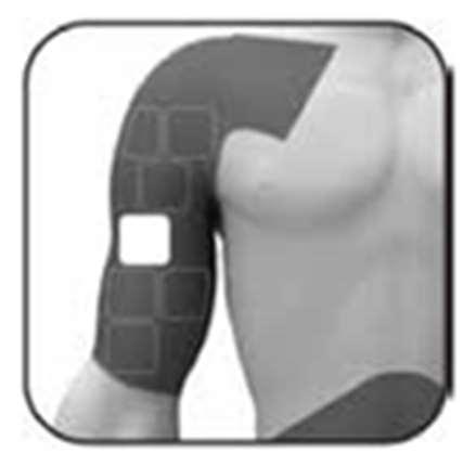 Braccio umano con area di iniezione evidenziata da riquadri scuri e un quadrato bianco centrale per indicare il sito