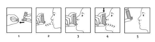 Sequenza di cinque disegni che mostrano l