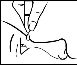 Mano che tiene una siringa inclinata, ago che penetra nella pelle, dettaglio del punto di iniezione e della zona cutanea circostante