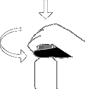 Iniezione sottocutanea con ago corto angolato a 45 gradi nella parte superiore del braccio con frecce che indicano il percorso