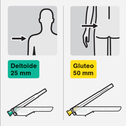 Schema che mostra iniezione intramuscolare nel deltoide a 25mm e nel gluteo a 50mm con siringhe illustrate