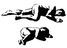 Paziente in posizione prona con la testa girata lateralmente e paziente in posizione fetale laterale sinistra