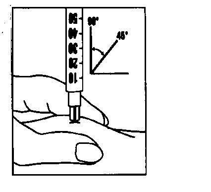 Siringa con ago che penetra nella pelle a 45 gradi mostrata su un braccio con indicazioni di profondità e angolazione