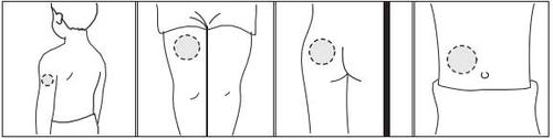 Schema corporeo con cerchi che indicano siti di iniezione sottocutanea su braccio, coscia e addome