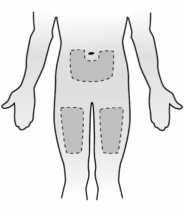 Schema del corpo umano con aree ombreggiate che indicano possibili siti di iniezione sottocutanea su addome e cosce