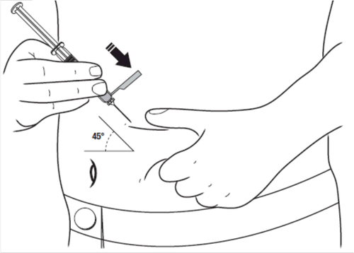 Mano che tiene una siringa inclinata a 45 gradi mentre l