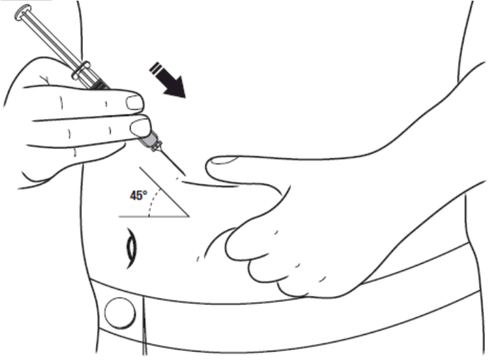 Mano che inietta farmaco sottocute con siringa a 45 gradi indicati da angolo e freccia nera su braccio