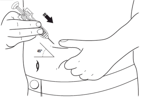 Mano che tiene una siringa inclinata a 45 gradi mentre inietta un farmaco nel braccio di un paziente con una freccia nera indicante la direzione