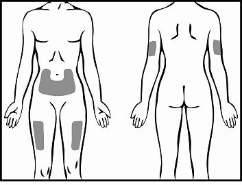 Schema del corpo umano con aree ombreggiate che indicano possibili siti di iniezione sottocutanea su addome, fianchi e cosce