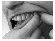 Persona che solleva la guancia con due dita per esaminare l