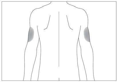 Schema del corpo umano con evidenziate le aree del braccio e della spalla in grigio chiaro
