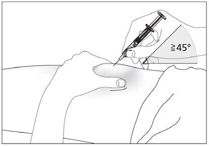 Mano che inserisce una siringa con ago nel tessuto a un angolo di almeno 45 gradi indicati da un cono grigio chiaro