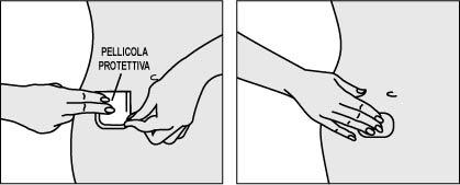 Mano che rimuove la pellicola protettiva da un cerotto medicato applicato sulla pelle del braccio e mano che preme il cerotto