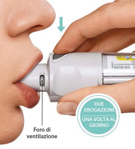 Spray nasale bianco con ugello in bocca e freccia blu che indica l