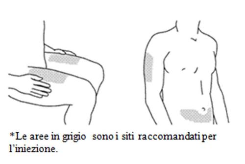 Schizzo di schiena e braccio umano con aree grigie indicate come siti raccomandati per iniezione e mano che applica pressione