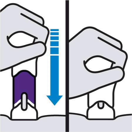 Mano che afferra il dispositivo autoiniettore con una freccia blu che indica la direzione di spinta verso il basso