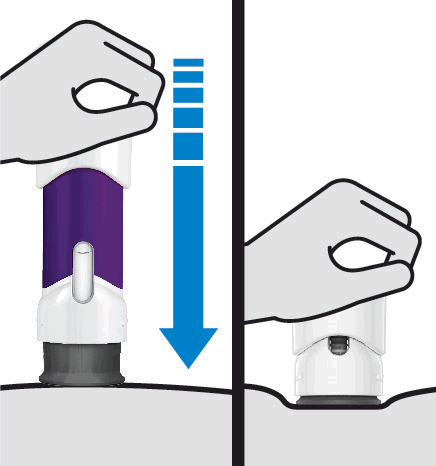 Dispositivo autoiniettante viola e bianco con ago protetto da cappuccio e freccia blu che indica la pressione verso il basso