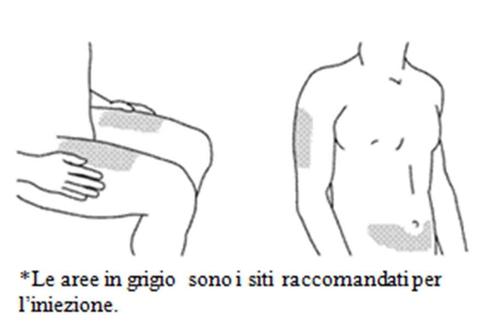 Schizzo di una mano che applica una medicazione su un braccio e schema della schiena con aree grigie indicate come siti di iniezione raccomandati