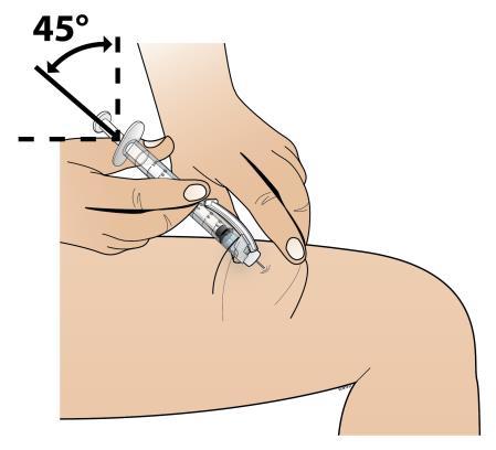 Mano che tiene una siringa inclinata a 45 gradi mentre inietta il farmaco nel braccio di un paziente