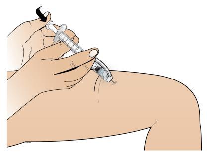 Mano che tiene una siringa e inietta il farmaco nel braccio, ago inserito nel tessuto con angolo di circa 45 gradi