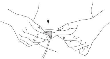 Mani che tengono un dispositivo di iniezione precompilato con ago esposto pronto per l