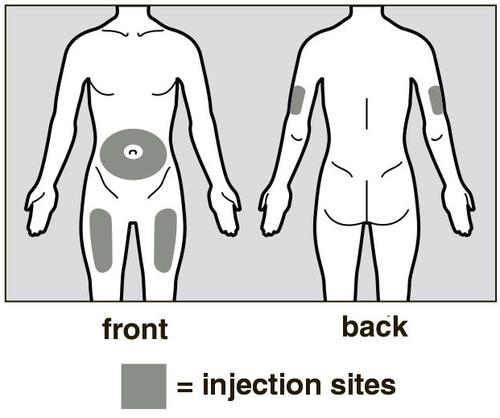 Schema corporeo con aree grigie che indicano i siti di iniezione sull