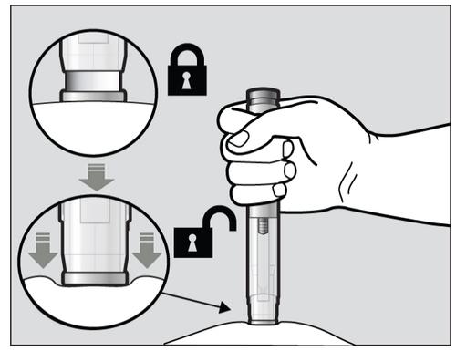 Mano che afferra un dispositivo medico con un meccanismo di blocco e sblocco indicato da lucchetti e frecce direzionali