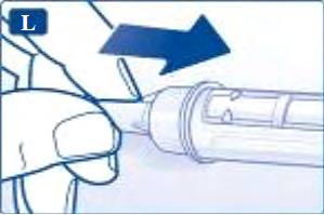 Siringa preriempita con ago inserito e freccia blu che indica la direzione di iniezione tenuta da una mano