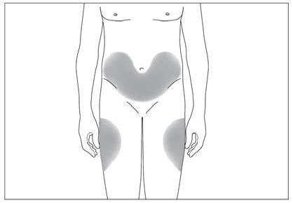 Schema del corpo umano con aree grigie che indicano i siti di iniezione nella regione addominale e glutei