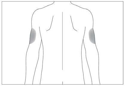 Schema del corpo umano stilizzato con evidenziate in grigio le aree deltoidee per l