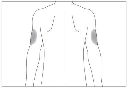 Schema del corpo umano stilizzato con aree ombreggiate sui deltoidi indicanti possibili siti di iniezione intramuscolare