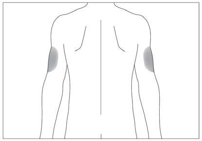 Schizzo del torso umano con le spalle evidenziate in grigio scuro indicando i siti di iniezione intramuscolare
