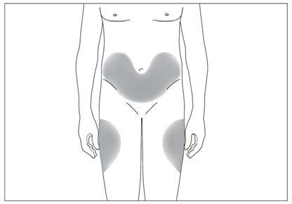 Torso umano stilizzato con evidenziate in grigio le aree di iniezione nella regione glutea e lombare laterale