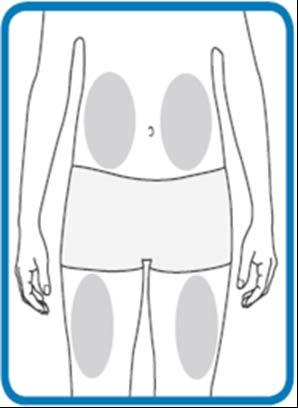 Schema del corpo umano femminile con aree ombreggiate che indicano i possibili siti di iniezione sottocutanea nell