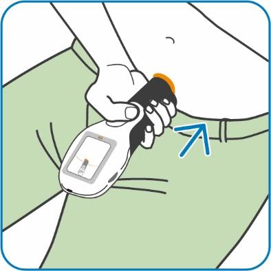 Mano che tiene un autoiniettore arancione con ago rivolto verso la pelle dell