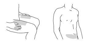 Schizzo di una mano che applica un cerotto adesivo sulla parte superiore del braccio di una persona
