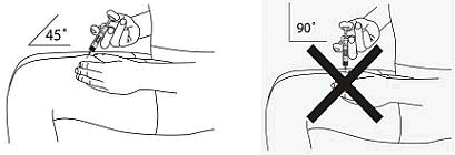 Iniezione sottocutanea corretta a 45&deg; e scorretta a 90&deg; su braccio umano con indicazione angolare e croce rossa