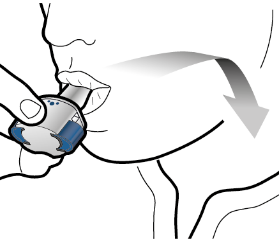 Dispositivo inalatorio bianco e blu tenuto tra le labbra con freccia grigia che indica la direzione dell