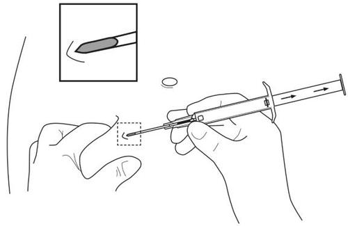 Mano che tiene una siringa inclinata per iniezione sottocutanea con dettaglio ingrandito dell