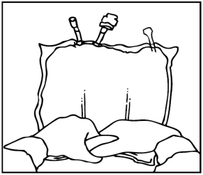 Mani che stringono un sacchetto per infusione con due tubi collegati e un supporto verticale