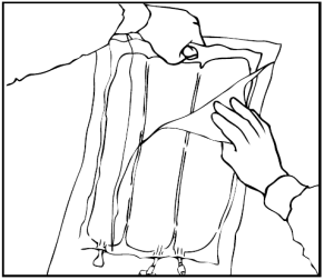 Mano che tira la pelle del gluteo per preparare l