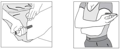 Iniezione sottocutanea nel gluteo e nel braccio con siringa pre-riempita e ago corto