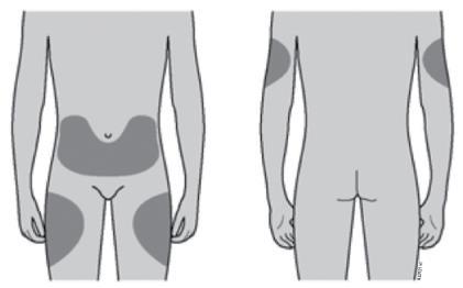 Corpo umano visto frontalmente e posteriormente con aree ombreggiate che indicano possibili siti di iniezione addominali e cosce