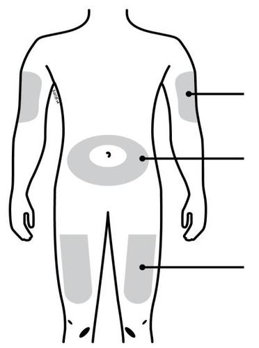 Schema del corpo umano con aree grigie che indicano possibili siti di iniezione sottocutanea su braccia, cosce e addome