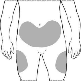 Schema del corpo umano con aree ombreggiate che indicano possibili siti di iniezione nell